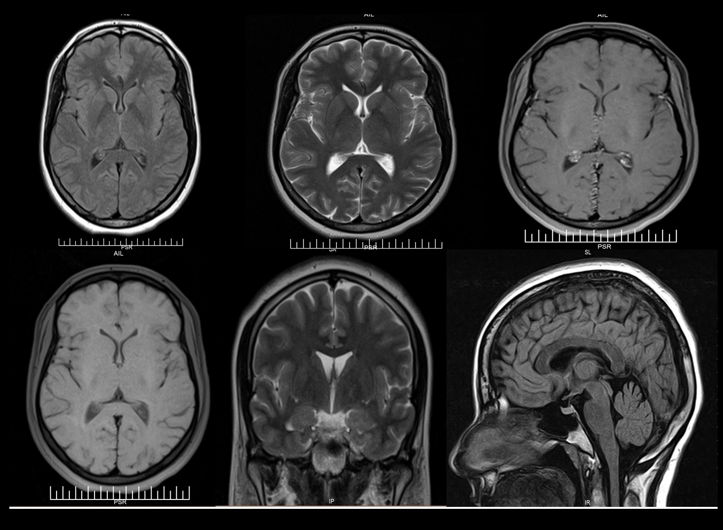 MRI/ Radiology/same day/dubai radiology center