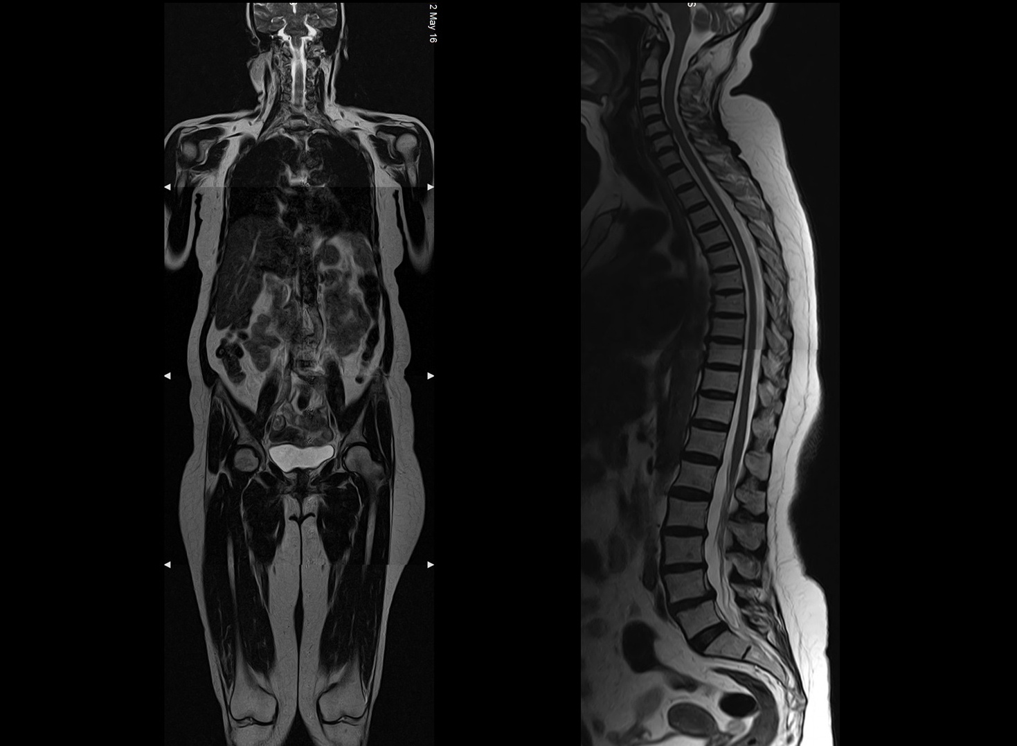 MRI/ Radiology/same day/dubai radiology center