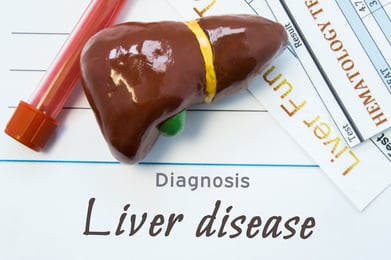 Chronic liver disease dubai