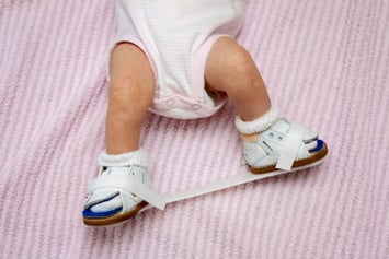 Clubfoot - DRHC Dubai Pedaitric Orthopedic Clinic