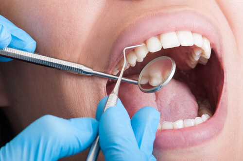 Dental Cleaning and Whitening Cost Dubai Dental Clinic