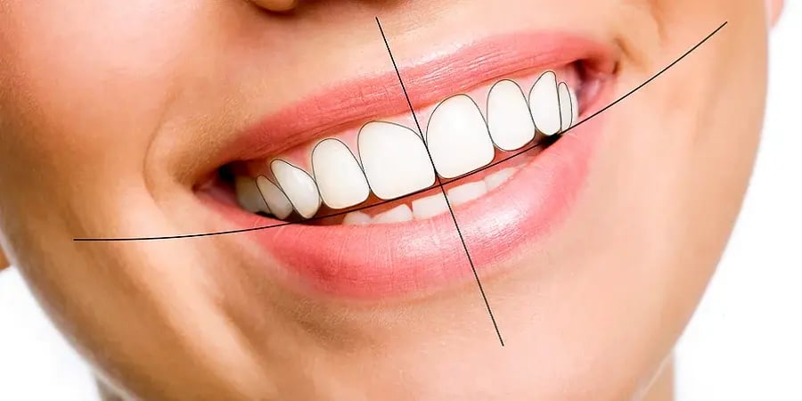 Digital Smile Design