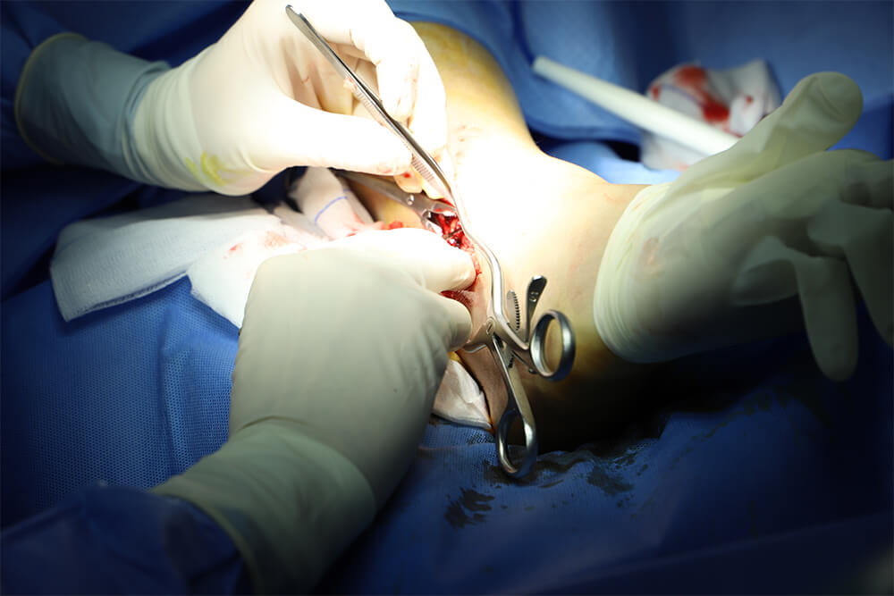 Orthopedic Department