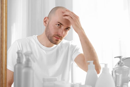 Genetic Hair Loss in Men - Hair Transplant Clinic in Dubai