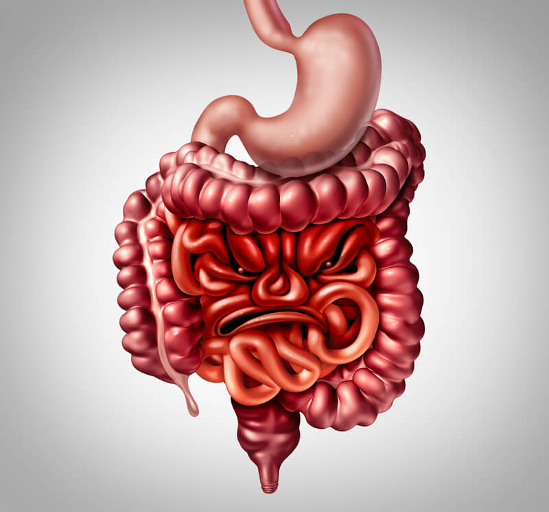 Irritable Bowel