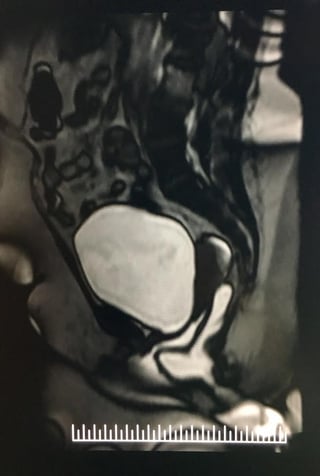 MRI-1.jpg