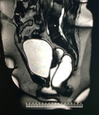 MRI-3.jpg