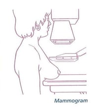 Mammogram 4.jpg