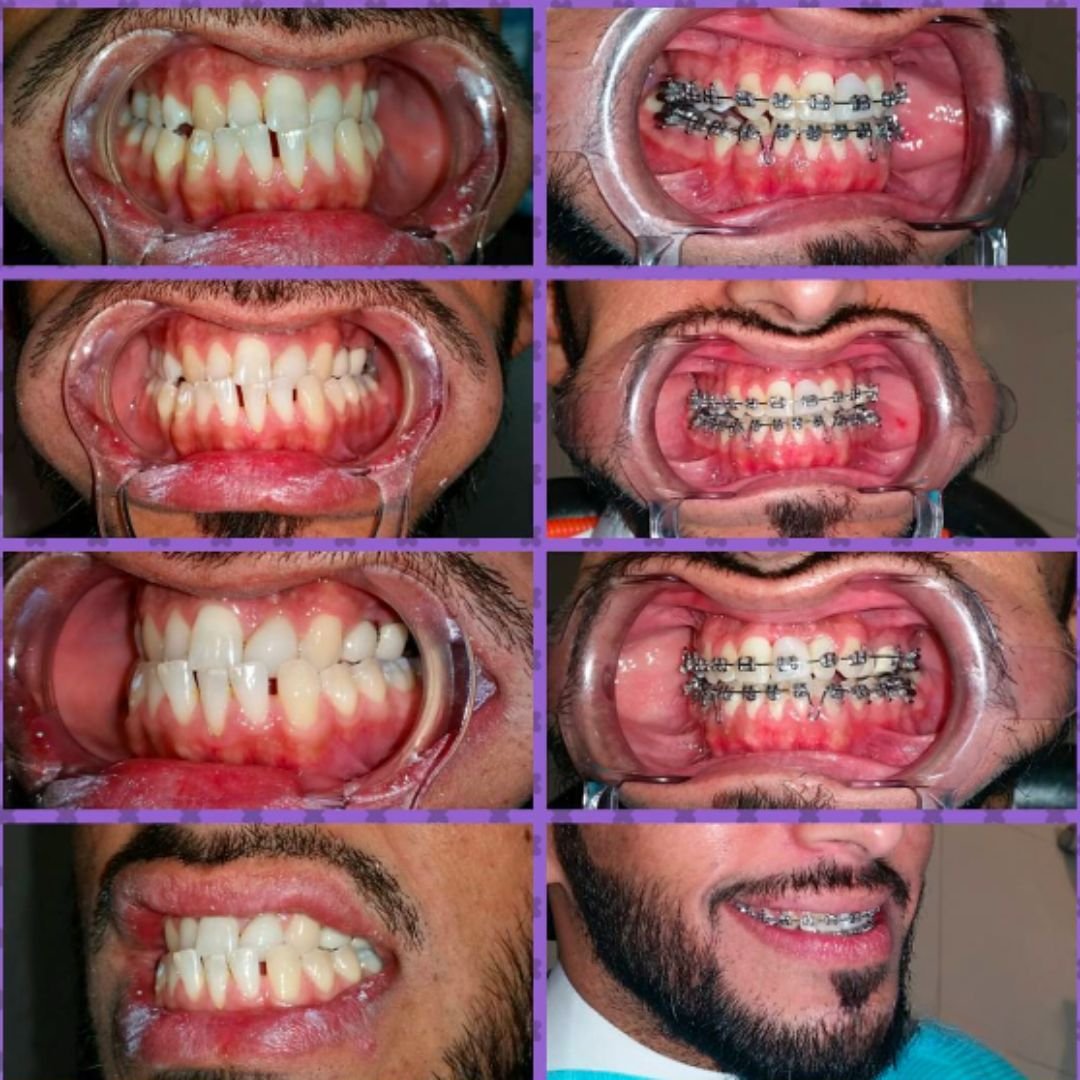Orthodontics