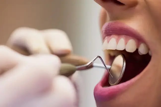 Periodontist in Dubai