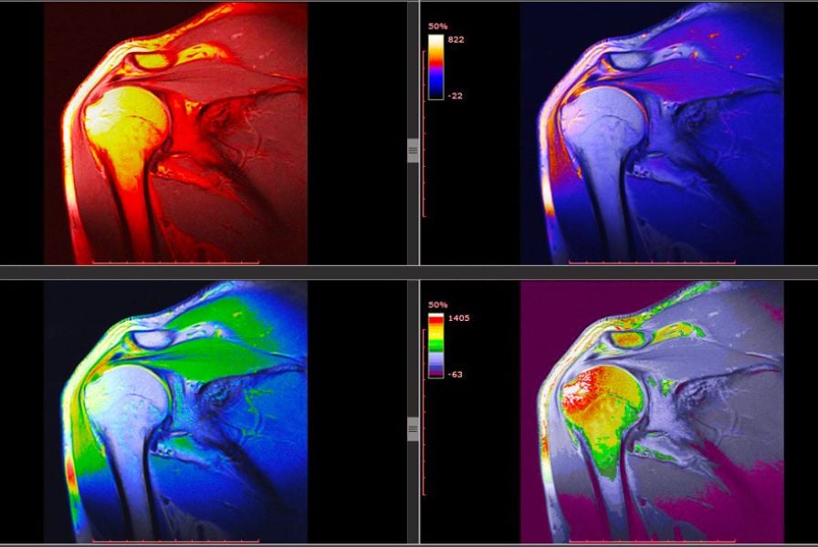Musculoskeletal Imaging Dubai Radiology Center