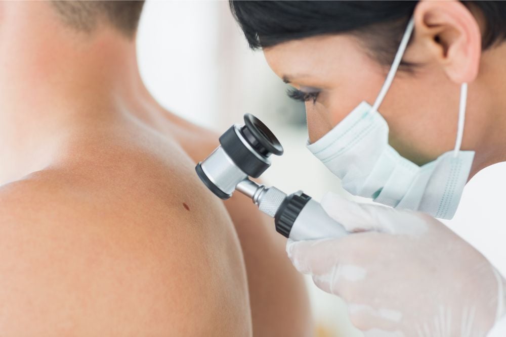 Skin Cancer Screening