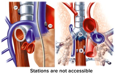 Stations are not accessible