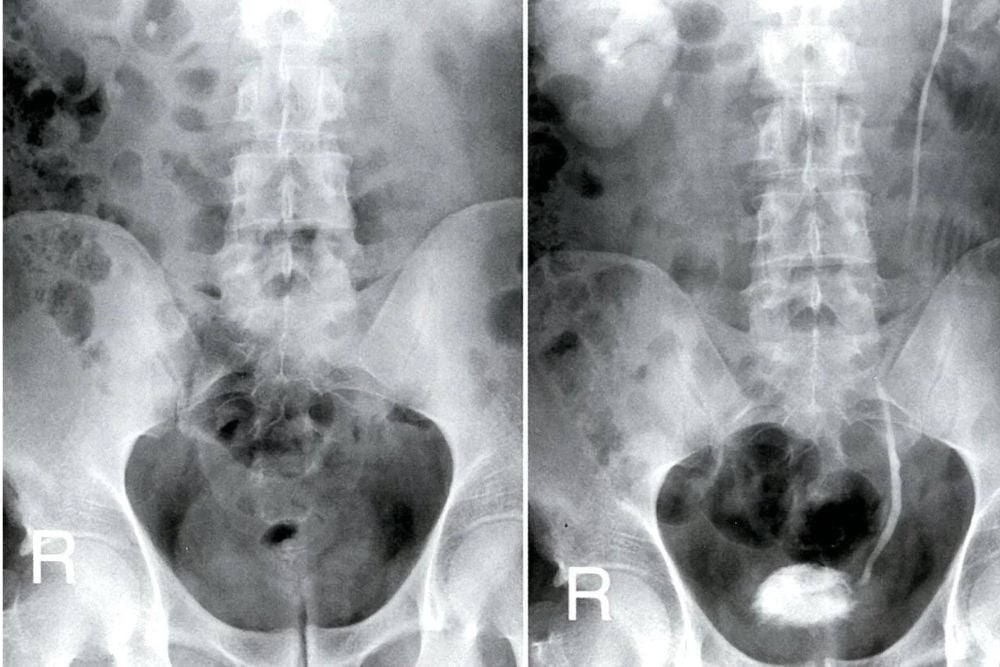 Urology Imaging