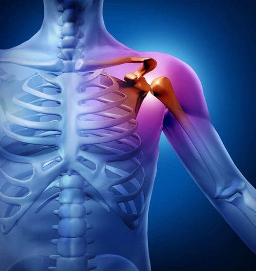 arthrits of the shoulder (1)