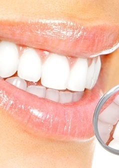 Teeth Whitening