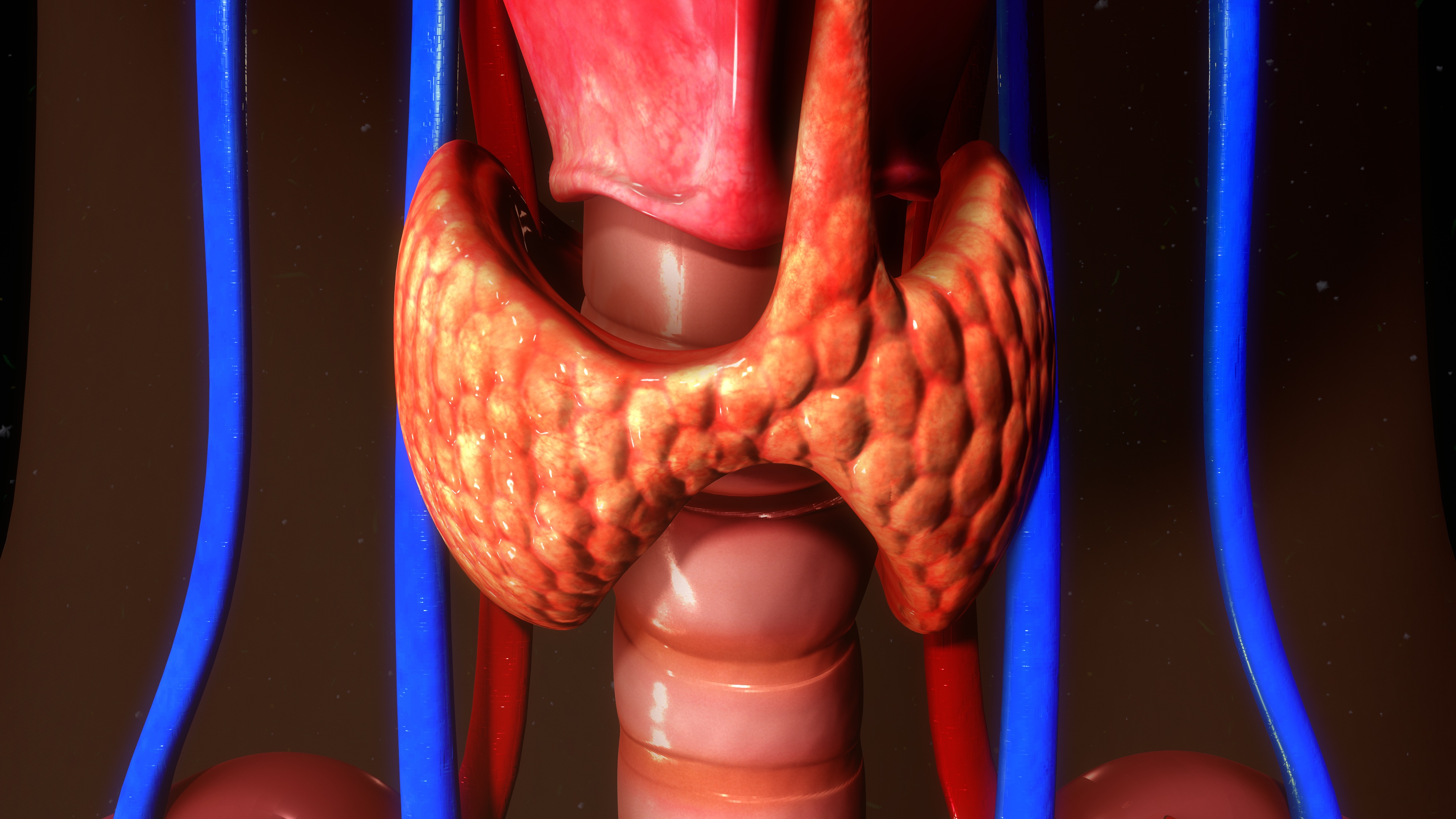 solitary thyroid nodule