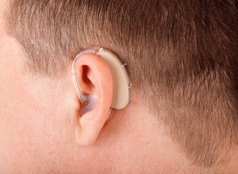 Bone Anchored Hearing Aid 