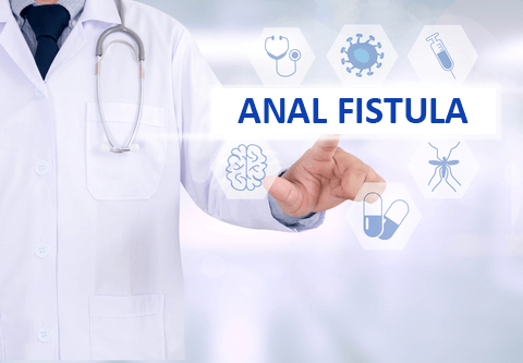 Anal Fistula