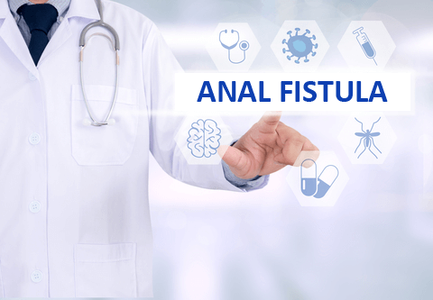 Anal Fistula Treatment - Dubai Hemorrhoids Clinic