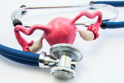 endometrial polyps Dubai Gynecology Clinic