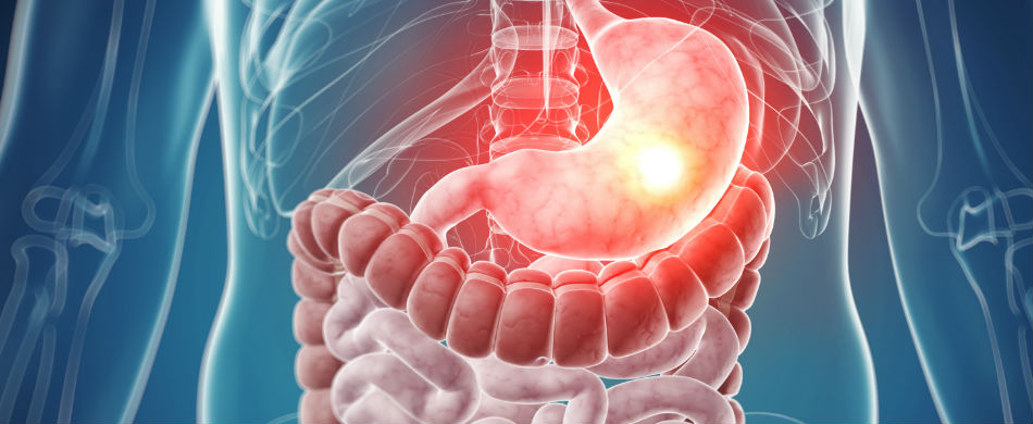 Gastric Balloon Package Gastric Balloon Package