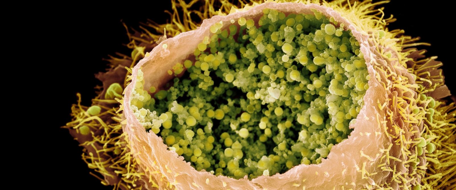 Chlamydia Trachomatis