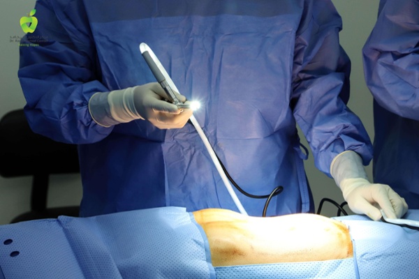 endoscopic spinal discectomy