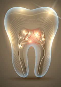 root canal