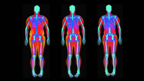 sample_of_a_dexa_scan
