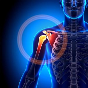 Shoulder Arthroscopy