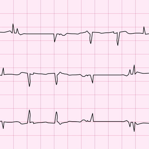 Heartbeat vector illustration