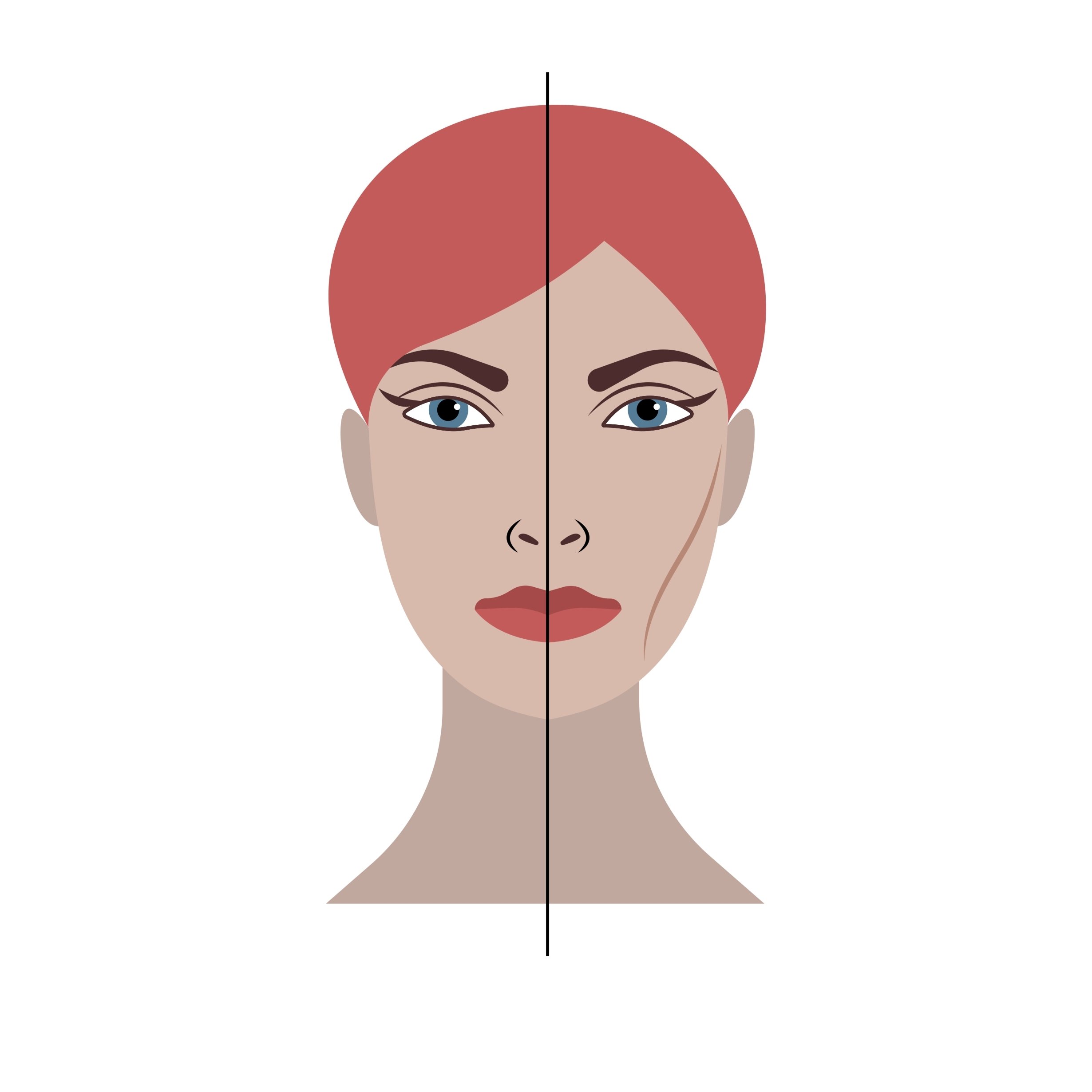 Buccal Fat Pad Removal Buccal Fat Pad Removal