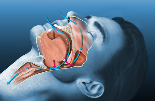 sleep apnea landing page (1)