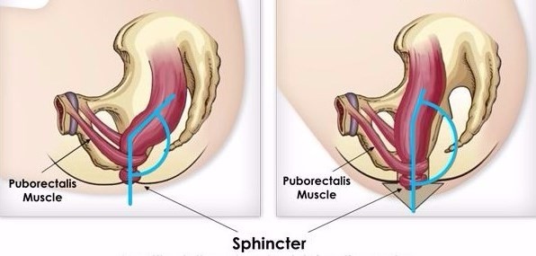 anal sphincter 