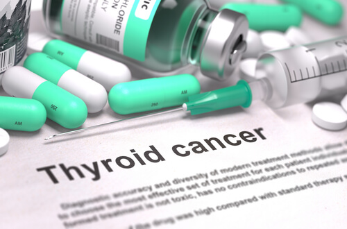 treatment of thyroid cancer Dubai thyroid clinic