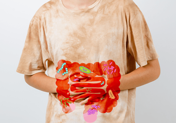 Irritable bowel syndrome (IBS) 
