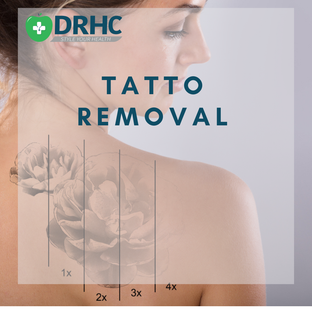 Tatto Removal