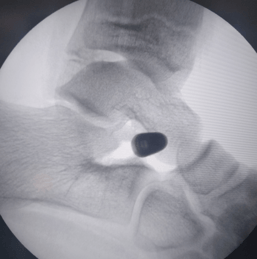 xray image - pediatric orthopedic clinic