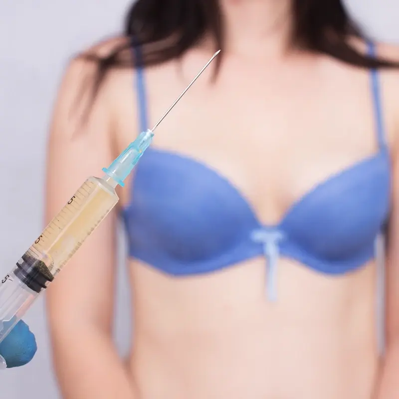 Breast Augmentation Fat Transfer