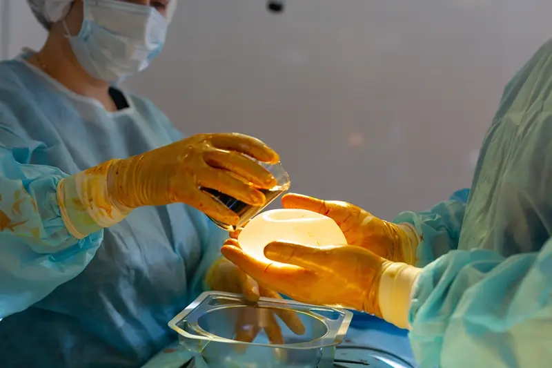 Breast Implant Revision