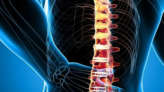 Can You Walk the Same Day After Spine Surgery? Exploring Fast-Recovery Options