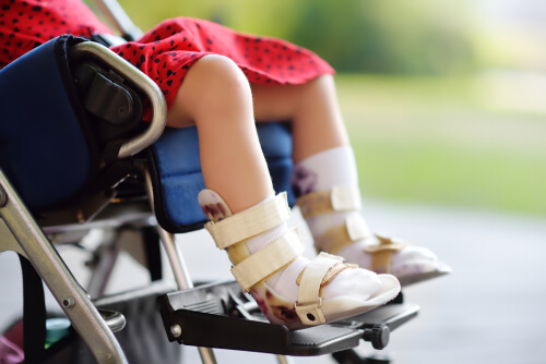 Cerebral Palsy Foot Conditions  Dubai Pediatric Orthopedic Clinic