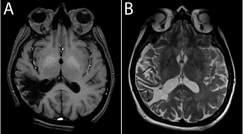 Contrast MRI Dubai