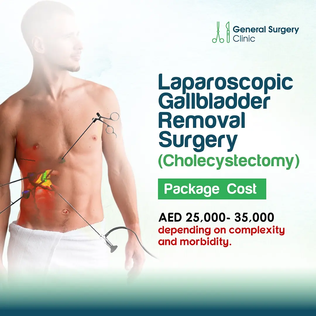 Laparoscopic Gallbladder Removal Surgery (Cholecystectomy) Laparoscopic Gallbladder Removal Surgery (Cholecystectomy)