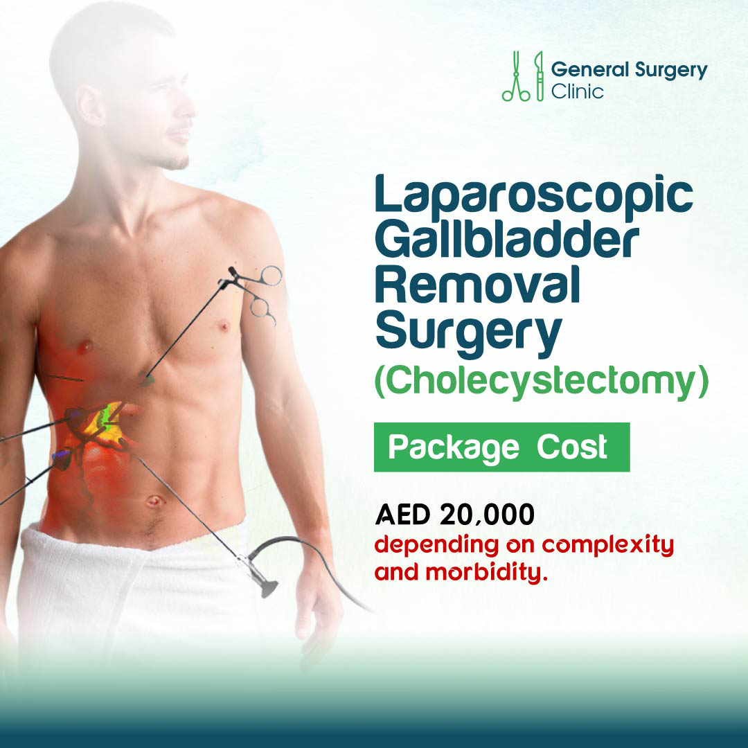 DRHC - General Surgery Packages_Laparoscopic Gallbladder surgery