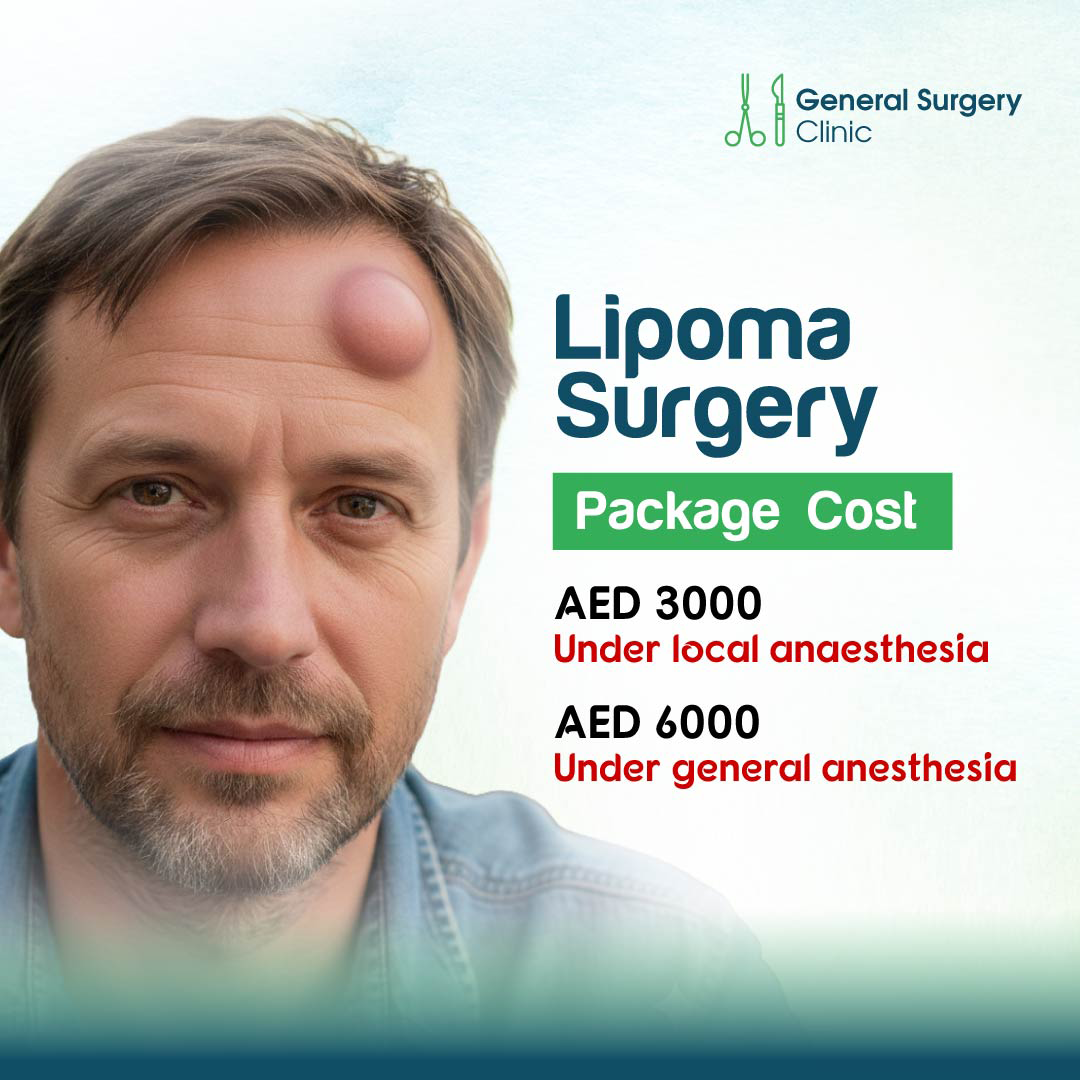 Cost of Lipoma Surgery