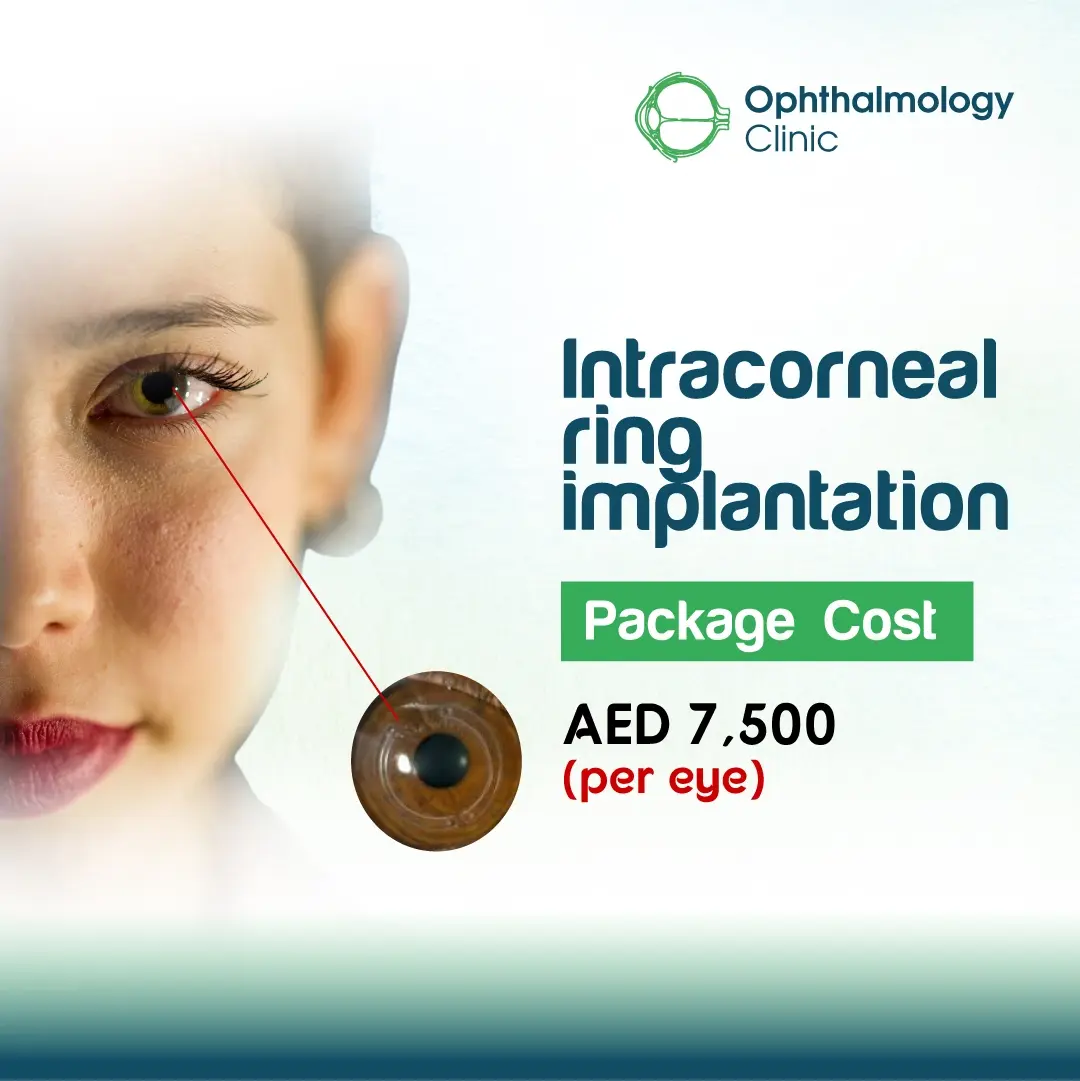 Intracorneal ring implantation Intracorneal ring implantation