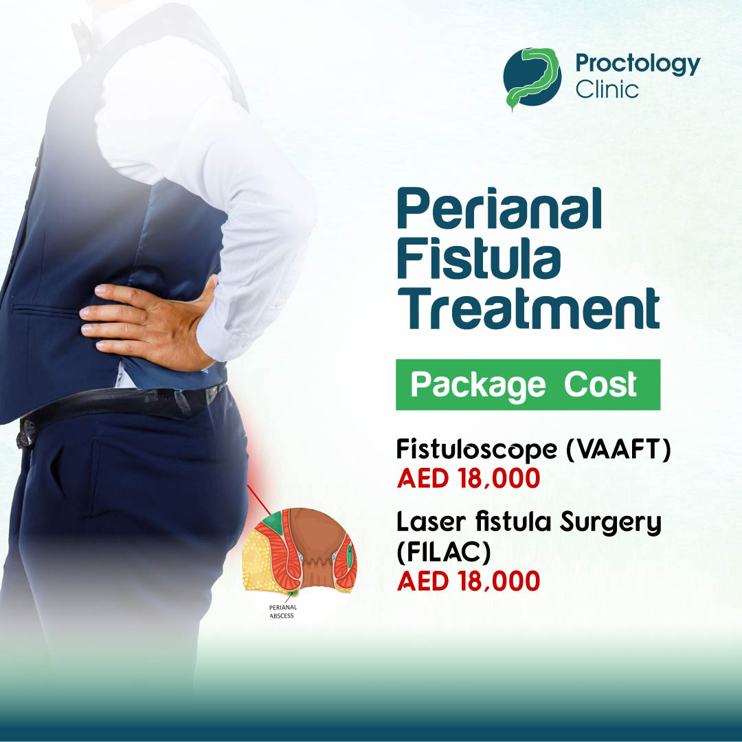 Perianal Fistula Treatment Cost