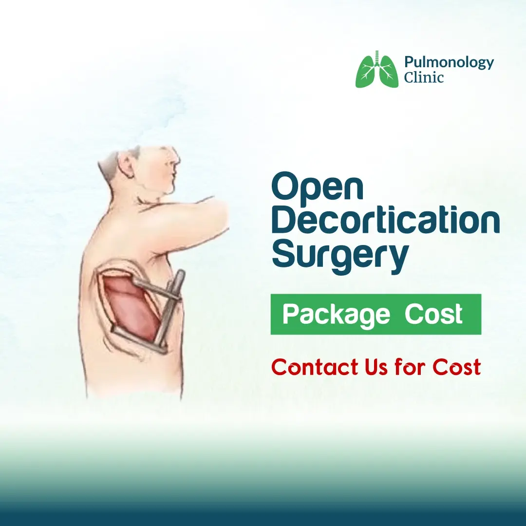 Open Decortication Surgery Open Decortication Surgery